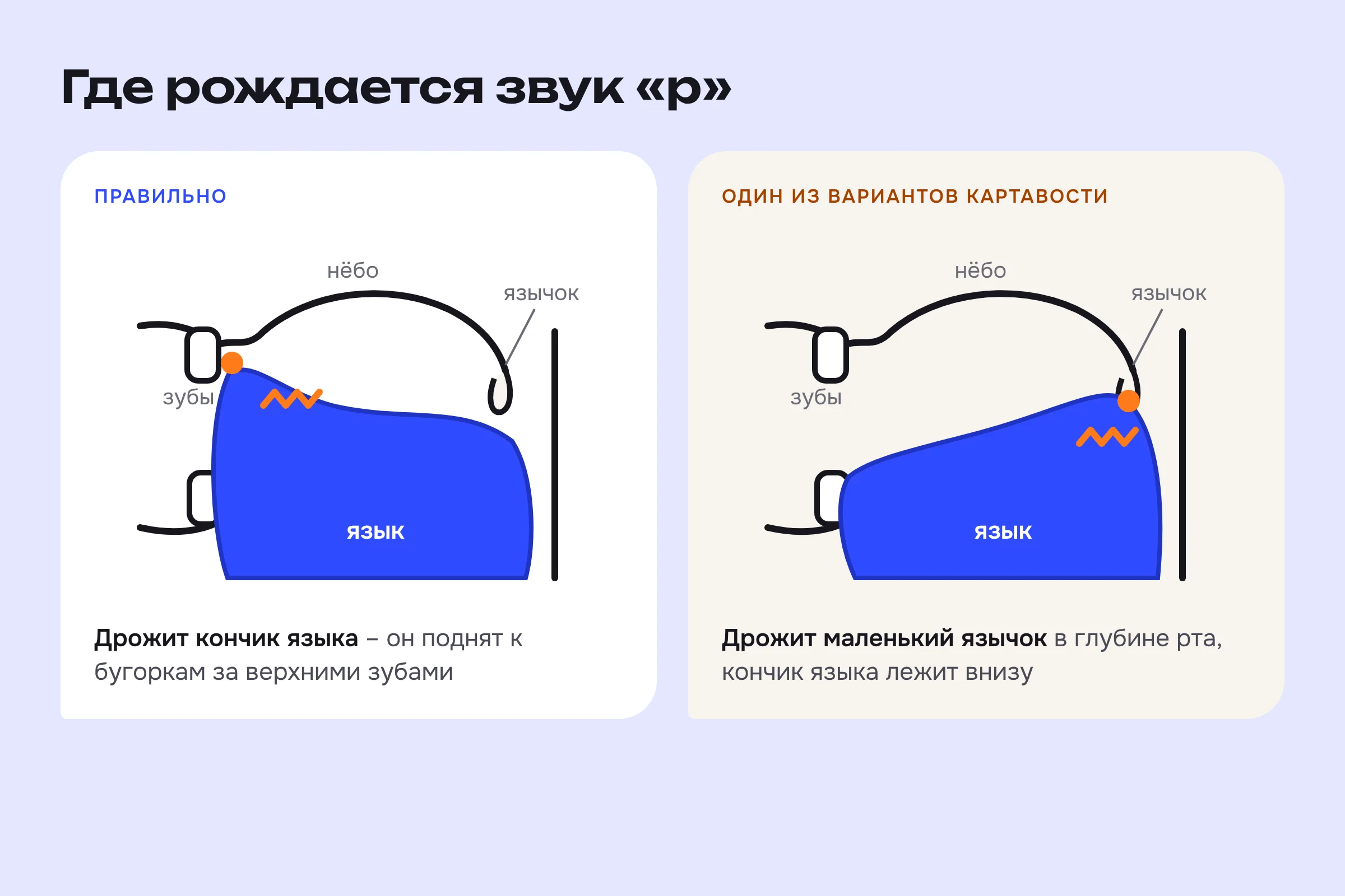 Где рождается звук «р»: правильно – дрожит кончик языка за верхними зубами; в одном из вариантов картавости дрожит маленький язычок в глубине рта